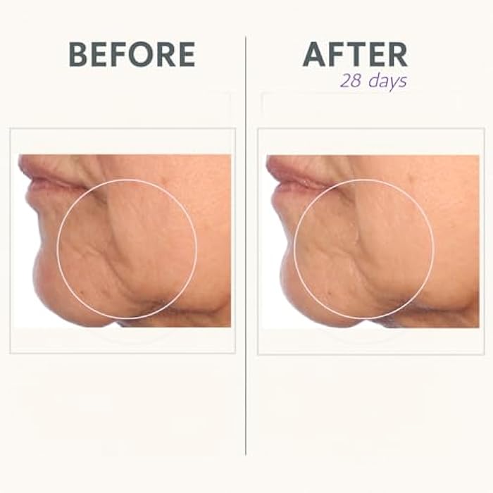 Serious Skincare Reverse Lift Cream In-Tense, Facial Moisturizer for Lifting & Firming, Day and Night, Hydrating, Anti-Aging Skin Care, Peptides, Face Tightening Plant Extracts 1.7 oz - Image 5