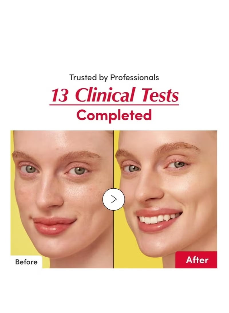 إيكوالبيري مجموعة إيكوال بيري الكاملة لتجديد وتفتيح البشرة - سيروم باكوتشيول 30 مل + سيروم فيتامين لتفتيح البشرة 30 مل - Image 5