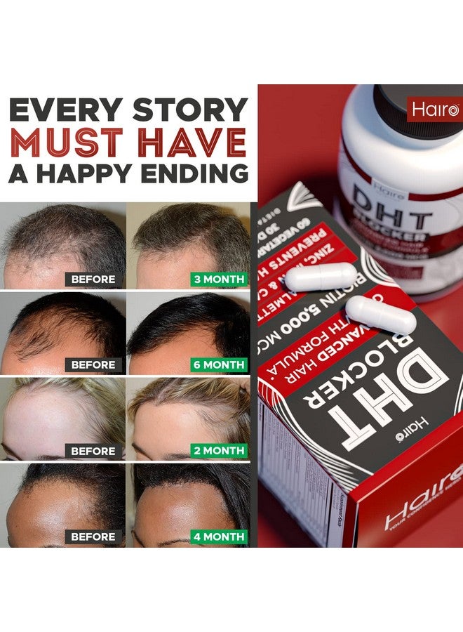 Hairo Nutrition مكمل نمو الشعر مانع DHT بيوتين عالي الفعالية ونخيل ساو بالميتو لنمو الشعر علاجات طبيعية لتساقط الشعر للنساء والرجال يساعد في تحفيز نمو بصيلات الشعر - Image 5