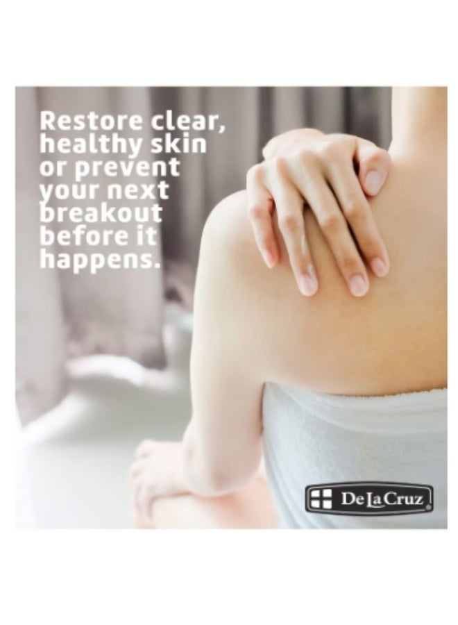 دي لا كروز كريم علاج حب الشباب دي لا كروز مع 10% كبريت 73.7 جرام - Image 4