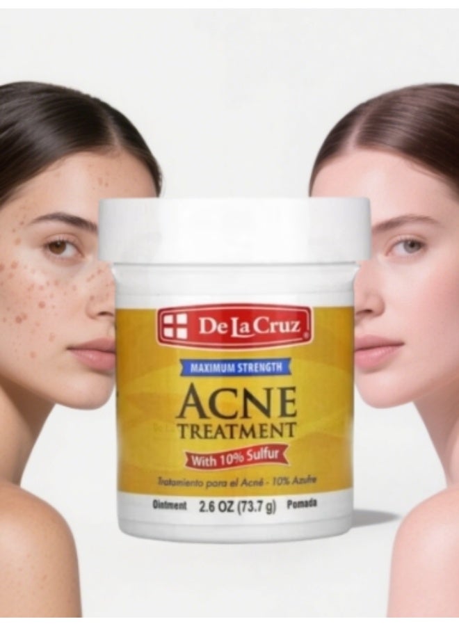 دي لا كروز كريم علاج حب الشباب دي لا كروز مع 10% كبريت 73.7 جرام - Image 1