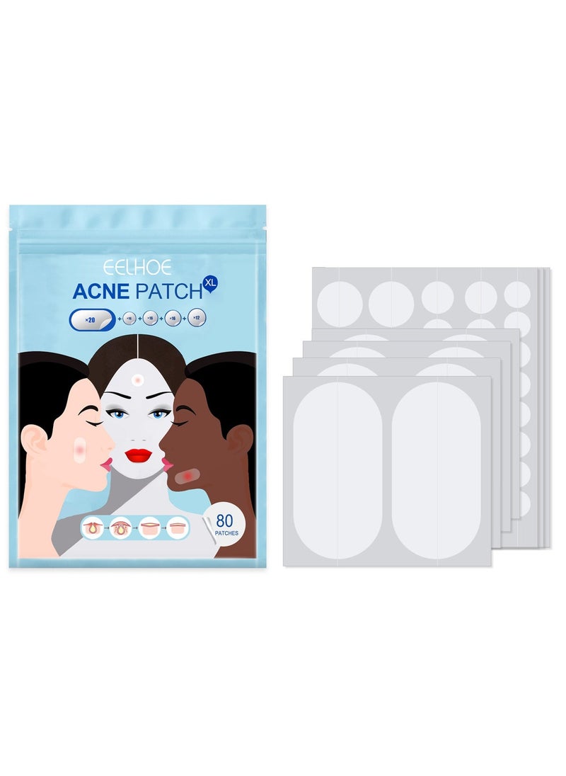 EELHOE Large Pimple Patches (5 Sizes 80 Patches), Acne Patches for Face, Chin, Back or Body, Hydrocolloid Patches Suitable for All Skin Types - Image 1