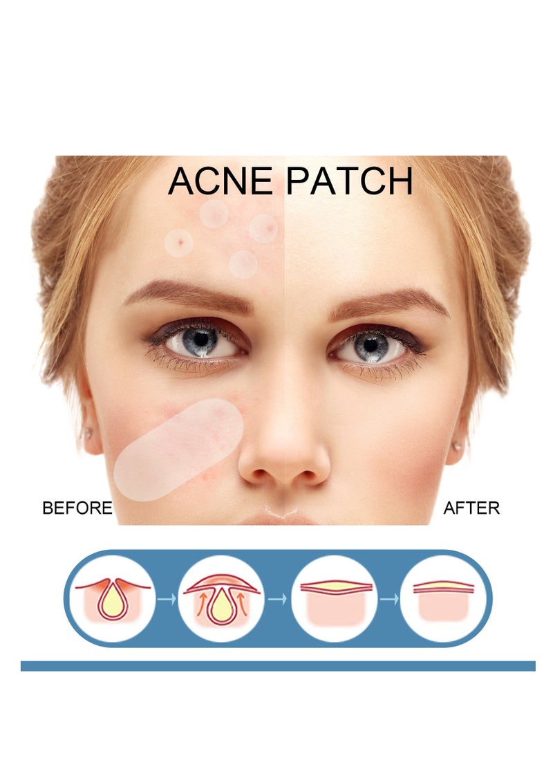 EELHOE Large Pimple Patches (5 Sizes 80 Patches), Acne Patches for Face, Chin, Back or Body, Hydrocolloid Patches Suitable for All Skin Types - Image 5