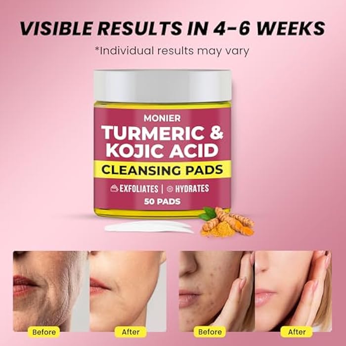 MONIER Turmeric Kojic Acid Cleansing Pads for Face Dark Spots - Hydrates & Plumps Skin - With Vitamin C & E - Sensitive Skin Friendly (50 Pads) - Image 2
