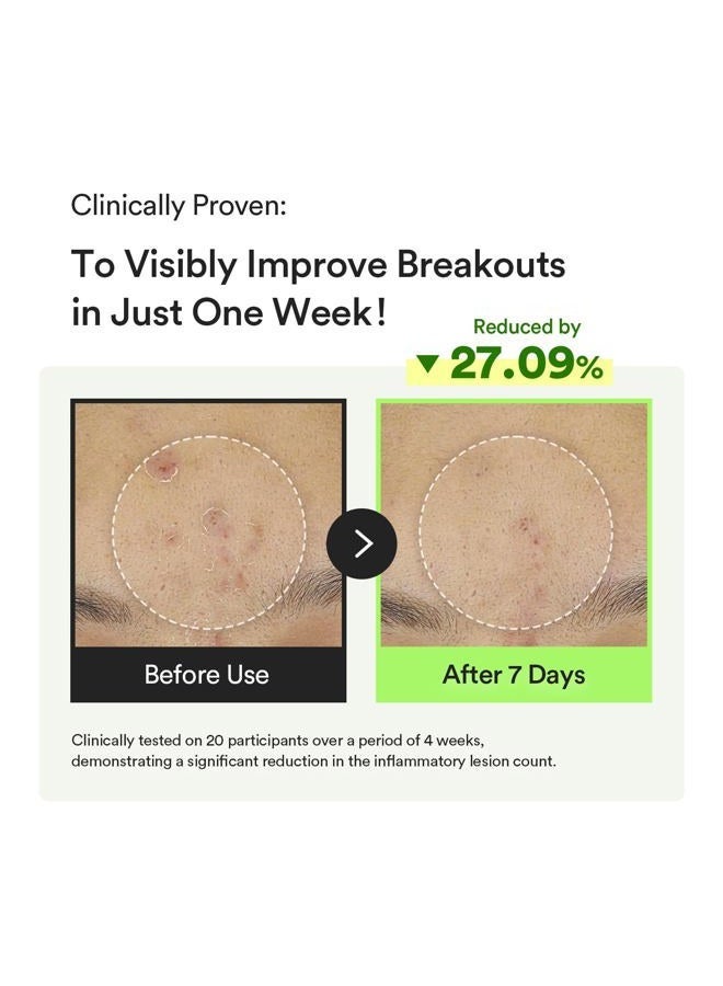 abib سيروم فيتا دروب لعلامات الداكنة جلوتاثيوم 1.69 أونصة سائلة | العناية بالبشرة الكورية، علاج البقع الداكنة، فرط التصبغ | سيروم تفتيح للبشرة الحساسة وغير المتساوية (1.69 أونصة سائلة، تيكا) - Image 5