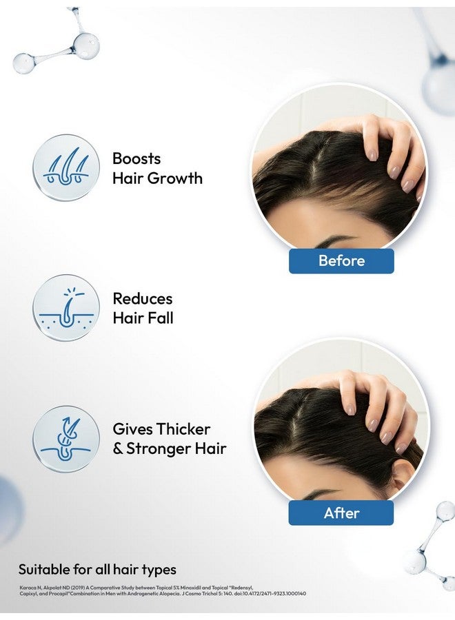 Scalpe Pro Hair Growth Serum With Applicator | 3% Redensyl, 4% Capixyl, 3% Procapil, 3% Anagain | Boosts Hair Growth | Thicker & Stronger Hair | Non-Sticky | Paraben & Sulphate-Free | Unisex | 30 Ml - Image 2