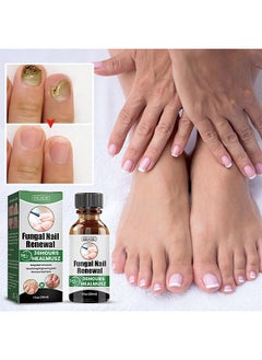 Toenail Fungus Treatment Extra Strength, Fungal Nail Renewal Treatment For Toe Nail and Fingernails, Nail Repair Solution For Thick, Broken, Discolored Nails, Renews Damaged Cracked Ingrown Toenail