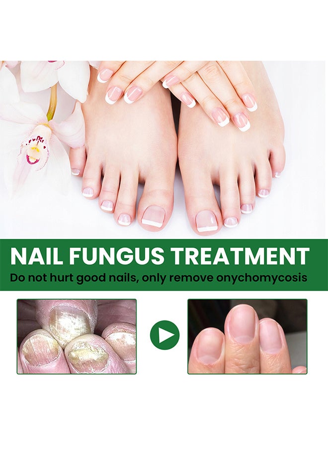 EELHOE - Toenail Fungus Treatment Extra Strength, Fungal Nail Renewal Treatment For Toe Nail and Fingernails, Nail Repair Solution For Thick, Broken, Discolored Nails, Renews Damaged Cracked Ingrown Toenail - Image 1