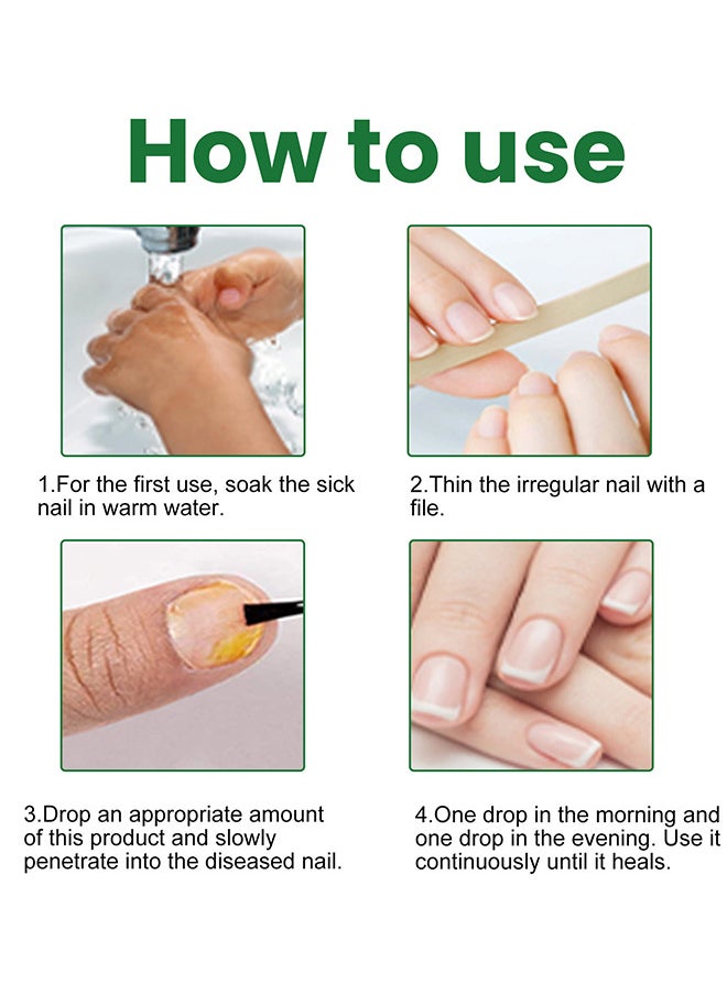 EELHOE - Toenail Fungus Treatment Extra Strength, Fungal Nail Renewal Treatment For Toe Nail and Fingernails, Nail Repair Solution For Thick, Broken, Discolored Nails, Renews Damaged Cracked Ingrown Toenail - Image 1