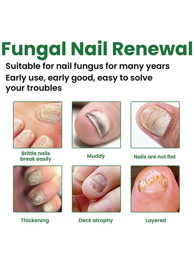 EELHOE - Toenail Fungus Treatment Extra Strength, Fungal Nail Renewal Treatment For Toe Nail and Fingernails, Nail Repair Solution For Thick, Broken, Discolored Nails, Renews Damaged Cracked Ingrown Toenail - Image 1