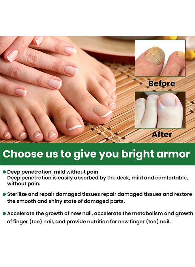 EELHOE - Toenail Fungus Treatment Extra Strength, Fungal Nail Renewal Treatment For Toe Nail and Fingernails, Nail Repair Solution For Thick, Broken, Discolored Nails, Renews Damaged Cracked Ingrown Toenail - Image 1