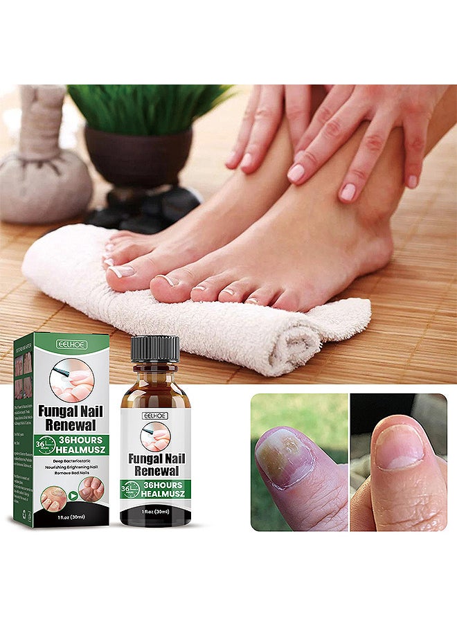 EELHOE - Toenail Fungus Treatment Extra Strength, Fungal Nail Renewal Treatment For Toe Nail and Fingernails, Nail Repair Solution For Thick, Broken, Discolored Nails, Renews Damaged Cracked Ingrown Toenail - Image 1