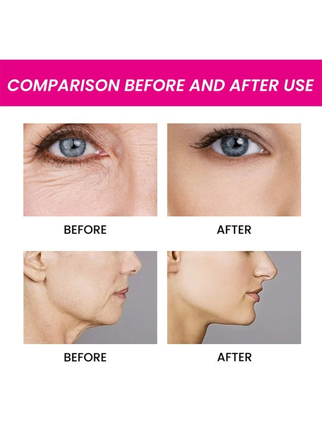 EELHOE Snail Facial Collagen Serum,Anti Acne & Whitening and Brightening Snail Collagen Booster Serum, Facial Serum Anti Aging with Collagen Booster 30ml  - Image 5