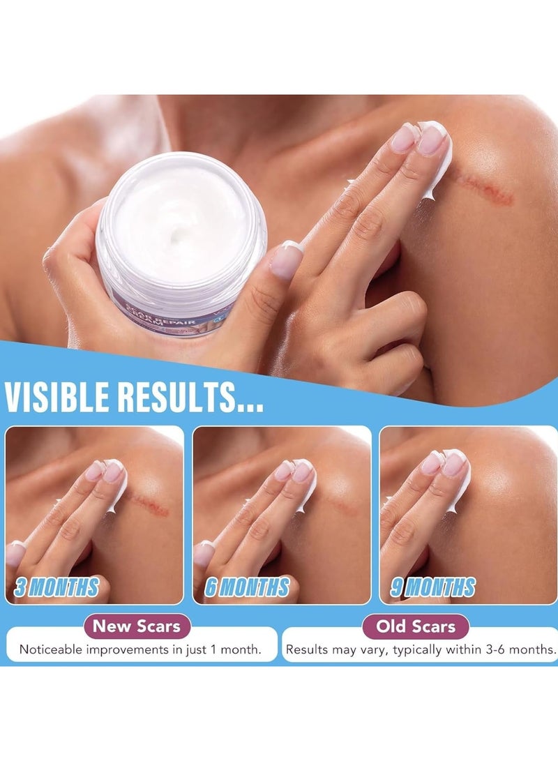 VOGSIG 50g Scar Removal Cream for Damaged Skin Surgery Scar Dead Skin Elimination Acne Scars Insect Bites and Pregnancy Lines Moisturizing and Skin Repair Reduce Scars and Mark Scar Repair Cream - Image 2