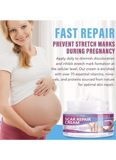 VOGSIG 50g Scar Removal Cream for Damaged Skin Surgery Scar Dead Skin Elimination Acne Scars Insect Bites and Pregnancy Lines Moisturizing and Skin Repair Reduce Scars and Mark Scar Repair Cream  - Image 3