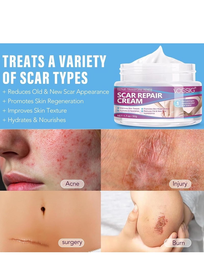 VOGSIG 50g Scar Removal Cream for Damaged Skin Surgery Scar Dead Skin Elimination Acne Scars Insect Bites and Pregnancy Lines Moisturizing and Skin Repair Reduce Scars and Mark Scar Repair Cream - Image 5