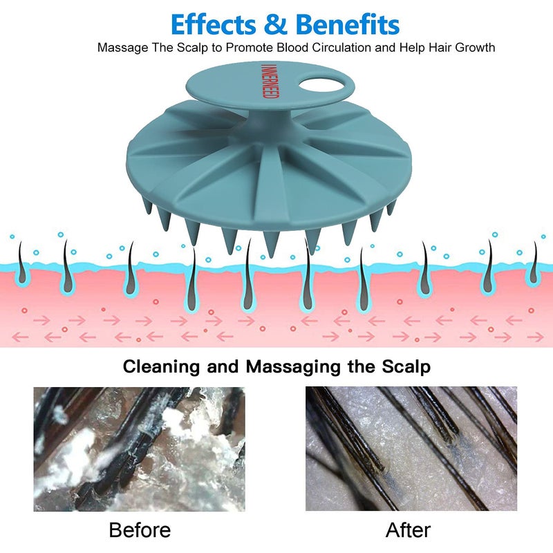 INNERNEED Scalp Massager Shampoo Brush, Wet & Dry Manual Scalp Care Head Scrubber Hair Washing, Soft Silicone Bristles, for Hair Growth, Dandruff Removal (Dark Green) - Image 4