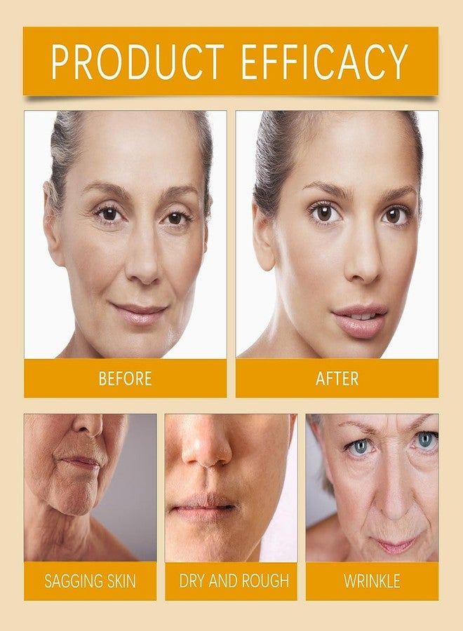 FYEBOO Bee Venom Moisturiser Cream Wrinkle Removal & Firming, Anti-Aging Eye & Face Bee Venom Skin Treatment Cream (1 Pack, 0.71Oz) - Image 5