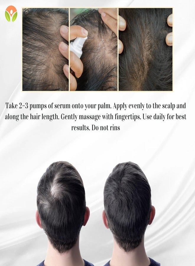 Shelby Anti Hair Fall Serum for Men & Women - 50ml | Reduces Hair Fall | Strengthens Roots | Promotes Hair Growth | Non-Greasy | All Hair Types - Image 5