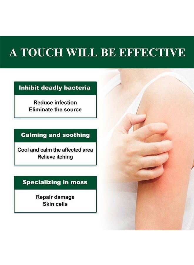 SOUTH MOON Advanced Psoriasis&Eczema Natural Herbal Cream，Organic Eczema Herbal Healing Cream, Chinese Herbal Eczema, Natural Herbal Cream, Psoriasis Ointment Cream, Moisturising Cream, Face Cream, Body Cream for Dry Skin, Itch Skin, Itch Relief Cream 20G  - Image 4