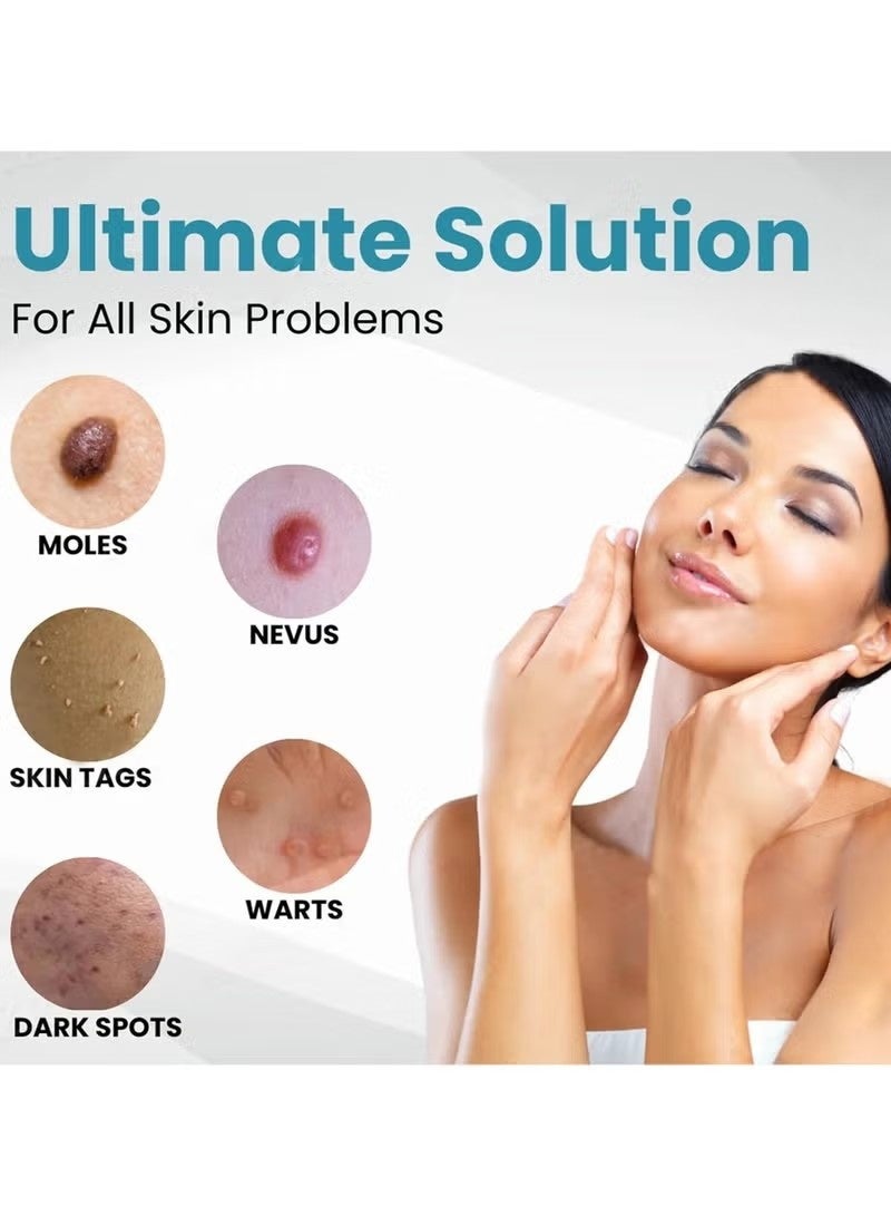 ATRJSZ Mole and Wart Removal Pen, Non-Invasive Mole and Wart Removal, Upgrade New Skin Tag Removal Pen, Smoothes and Reduces Blemishes,Suitable for All Types - Image 4