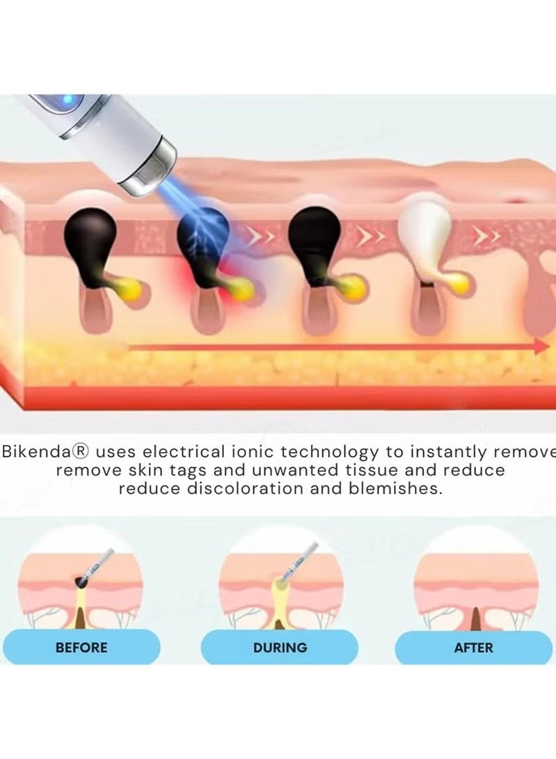 ATRJSZ Mole and Wart Removal Pen, Non-Invasive Mole and Wart Removal, Upgrade New Skin Tag Removal Pen, Smoothes and Reduces Blemishes,Suitable for All Types - Image 5