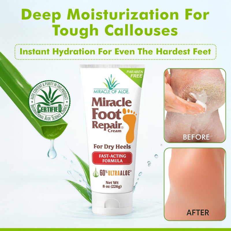 Miracle of Aloe Miracle Foot Repair Cream (8 oz & 1 oz) Repairs Dry Cracked Heels and Feet, 60% Pure UltraAloe Moisturizes, Softens, and Repairs - Image 3