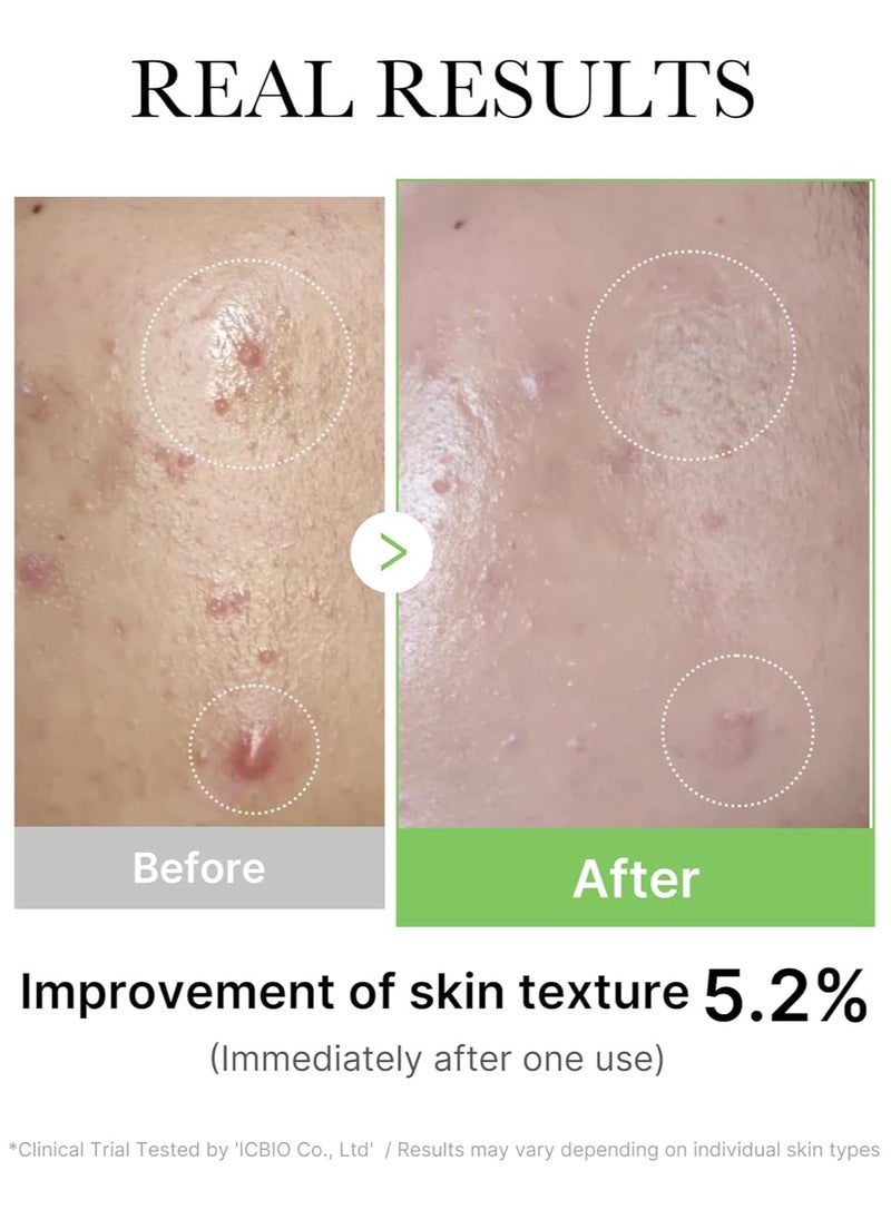 Medicube Exosome Cica Tea Tree Ampoule for Sensitive Skin with Centella Asiatica help reduce redness and breakouts. Low-irritating, Moisturizing & Soothing Serum | Korean Skincare | 30ml  - Image 3