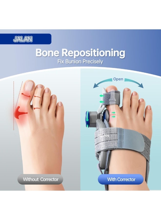 jalan Bunion Corrector for Men and Women, Universal Fit for Left and Right Foot, Breathable and Non-Slip, Pain Relief, Adjustable Dial Toe Alignment Splint - Image 5