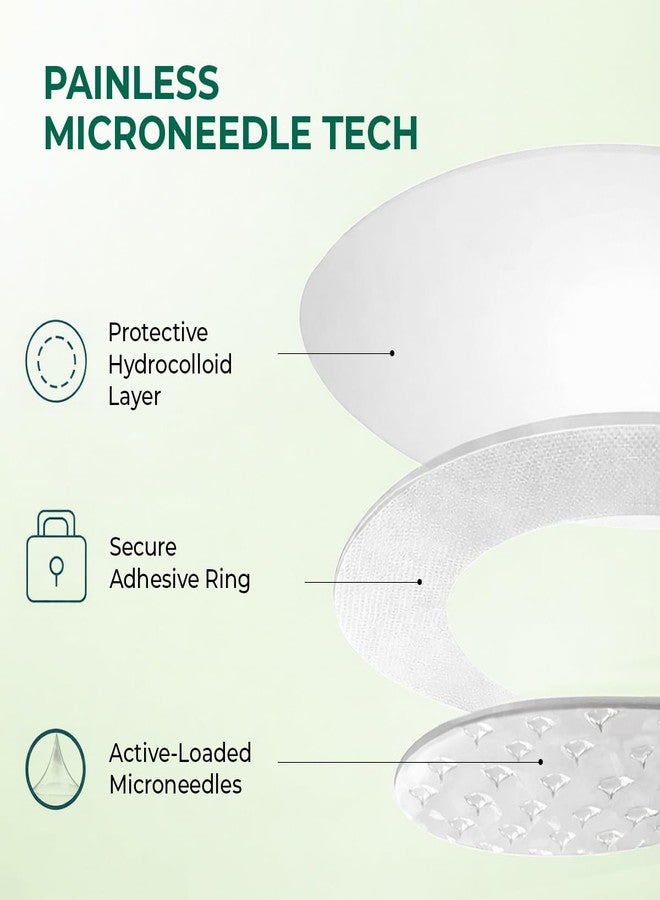 Conscious Chemist® Self Dissolving Microneedle Acne Patches (Pack of 8 Patches) | Painless & Effective Pimple Patches with 2% Salicylic Acid, Azelaic Acid & Niacinamide | Kills Bacteria, Reduces Redness, Scarring & Excess Sebum | Visible Results in 6 Hours - Image 5