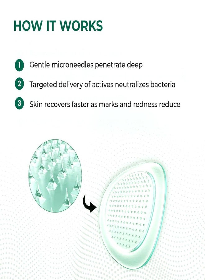 Conscious Chemist® Self Dissolving Microneedle Acne Patches (Pack of 8 Patches) | Painless & Effective Pimple Patches with 2% Salicylic Acid, Azelaic Acid & Niacinamide | Kills Bacteria, Reduces Redness, Scarring & Excess Sebum | Visible Results in 6 Hours - Image 4
