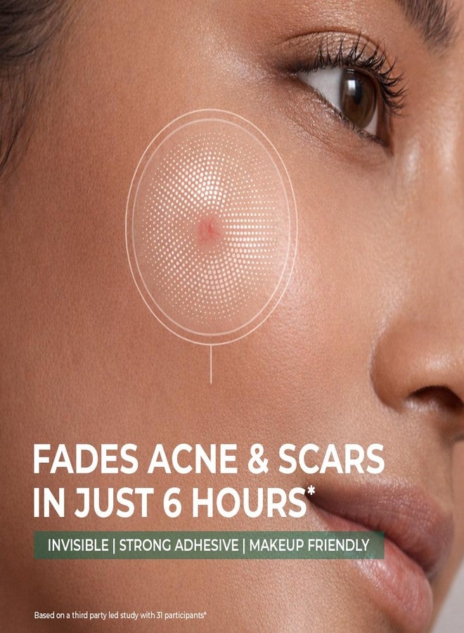 Conscious Chemist® Self Dissolving Microneedle Acne Patches (Pack of 8 Patches) | Painless & Effective Pimple Patches with 2% Salicylic Acid, Azelaic Acid & Niacinamide | Kills Bacteria, Reduces Redness, Scarring & Excess Sebum | Visible Results in 6 Hours - Image 3