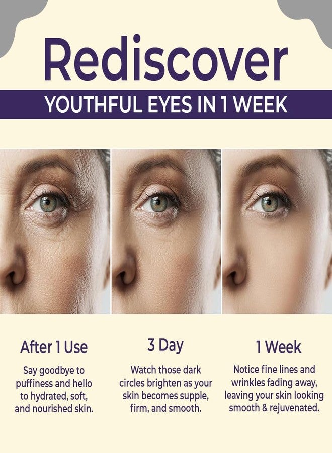 سانفي كريم سانفي لتفتيح وإخفاء الهالات السوداء تحت العينين | للهالات السوداء والتجاعيد والانتفاخات | للنساء، 20 غرام - Image 4