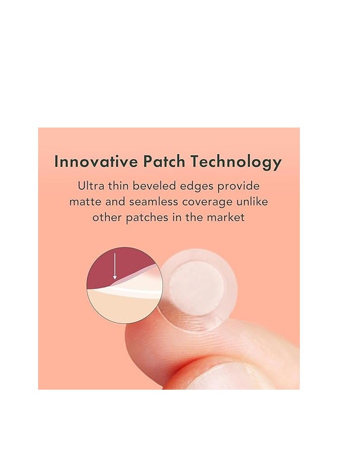 Rael Acne Pimple Healing Patch - Absorbing Cover, Invisible, Blemish Spot, Hydrocolloid, Skin Treatment, Facial Stickers, Two Sizes 10mm & 12mm (96 Count)  - Image 3