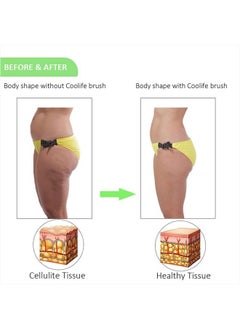 Coolife Ingrown Hair Remover, Razor Bumps Keratosis Pilaris KP Repair Brush, After Shave or Wax Exfoliator for Face, Bikini, Legs, Arms - Fascia, Cellulite Blast Massager Tool for Men and Women  - Image 4