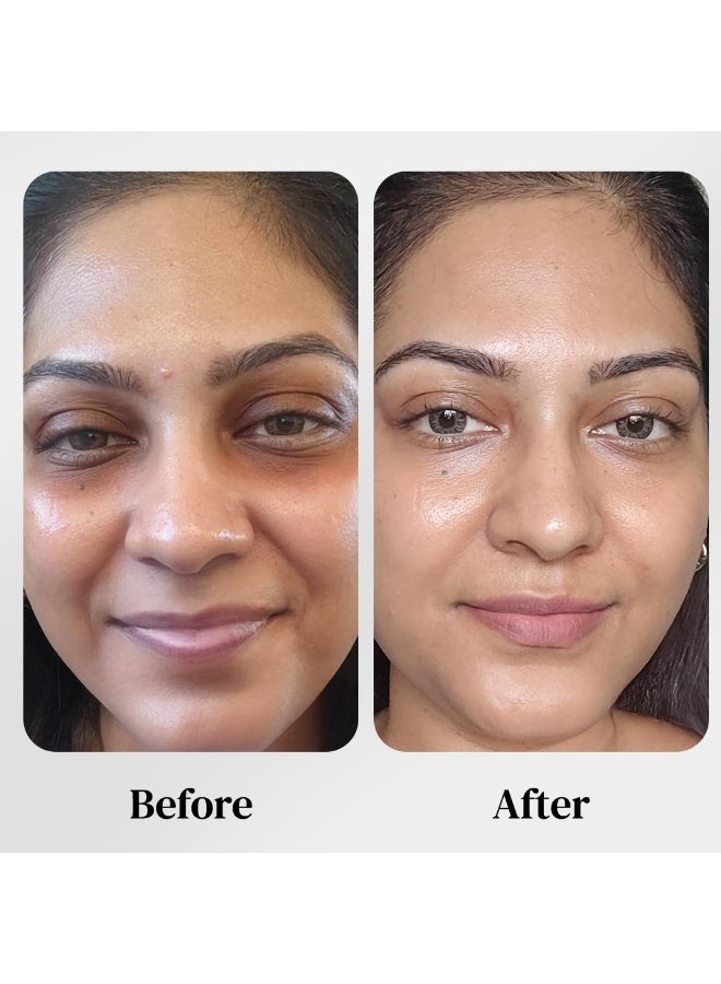 Mitchell USA Lineless Eye Serum – Peptide & Lotus Bio-Repair – Reduces Dark Circles, Wrinkles & Puffiness Lightweight Anti-Aging Formula 15ml - Image 2