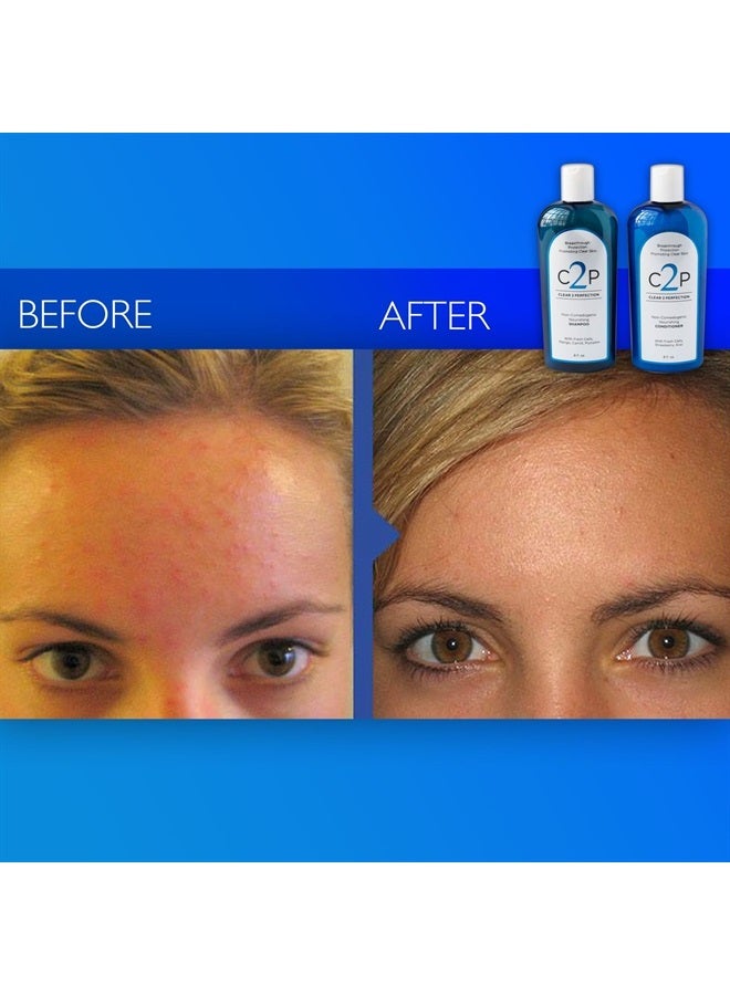C2P CLEAR 2 PERFECTION Non-Comedogenic Shampoo & Conditioner Set for Blemish Free Skin with Antioxidants and Fresh Cells. Acne Shampoo and Conditioner - Made in the USA. - Image 5