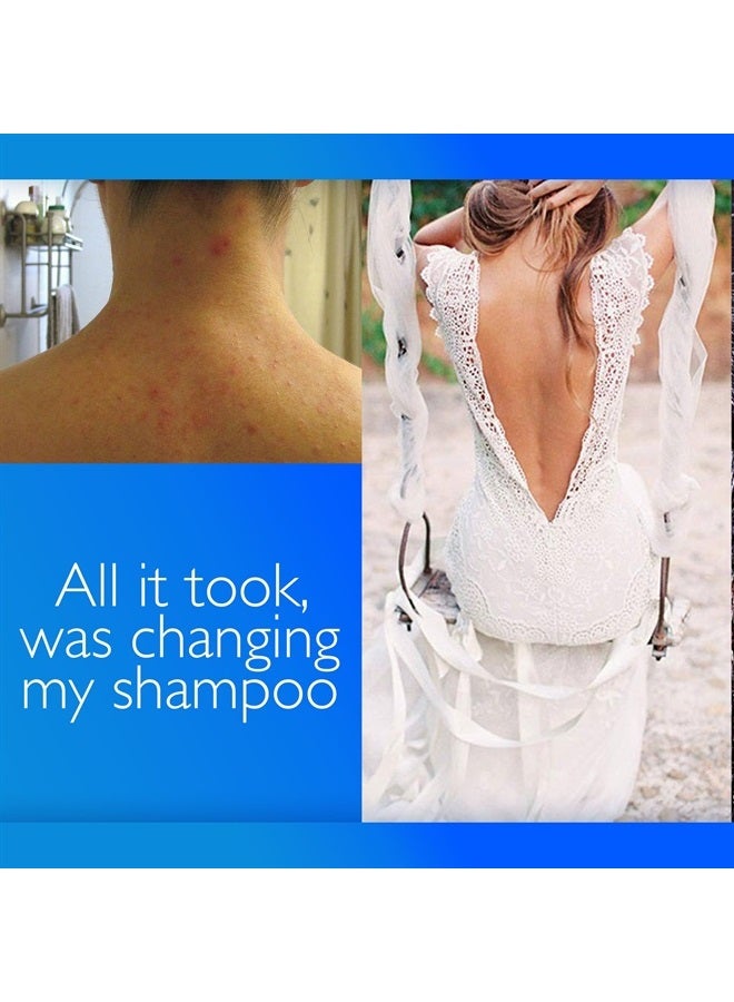 C2P CLEAR 2 PERFECTION Non-Comedogenic Shampoo & Conditioner Set for Blemish Free Skin with Antioxidants and Fresh Cells. Acne Shampoo and Conditioner - Made in the USA. - Image 4