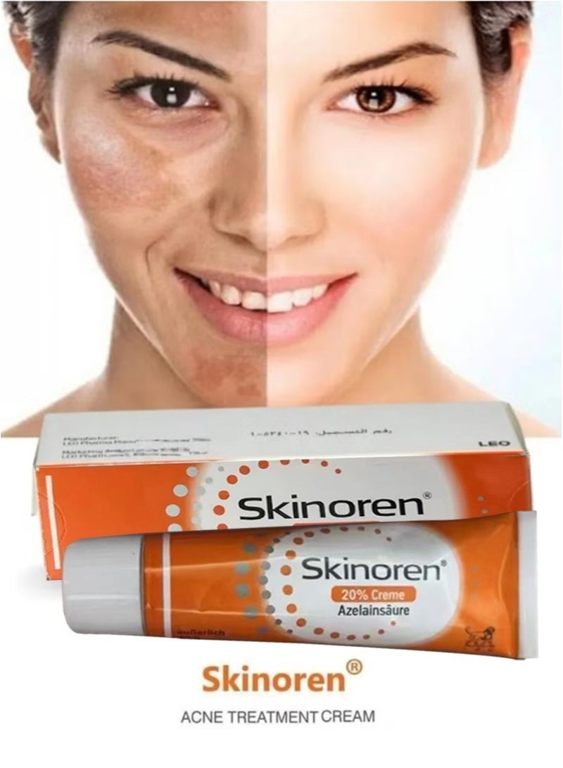 Skinoren Anti Acne Treatment Cream,Original Freshness Cream to Lighten the Skin,Treat Pimples,Melasma and Acne 30g - Image 2