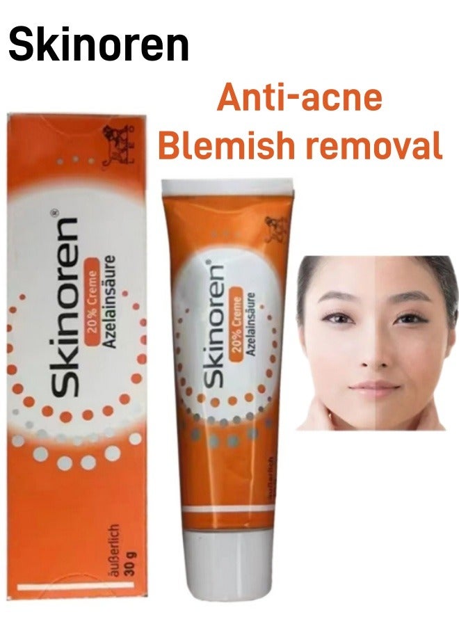 Skinoren Anti Acne Treatment Cream,Original Freshness Cream to Lighten the Skin,Treat Pimples,Melasma and Acne 30g - Image 1