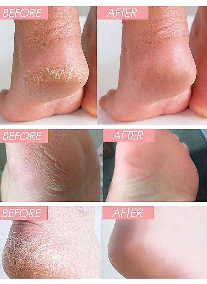 OCHEAL - Anti Cracking Petrolatum Moisturizing Ointment, Anti Drying Anti Crack Care Cream For Foot Hand And Lips Cracked Repair Body Cream Cracked Feet Cream Repair And Softens Skin Moisturizer 40G - Image 1