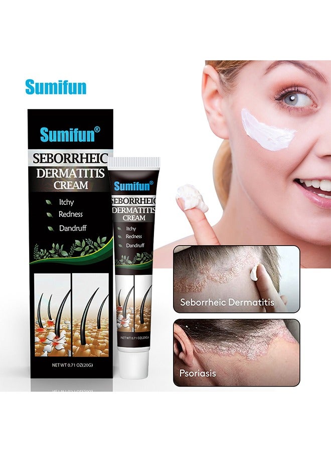 Sumifun Scalp care cream,cream For Scalp Prone To Folliculitis, Dermatitis, Dandruff, Mites, Itchy And Flaky Scalp, Treats Dandruff And Seborrheic Dermatitis - Image 1