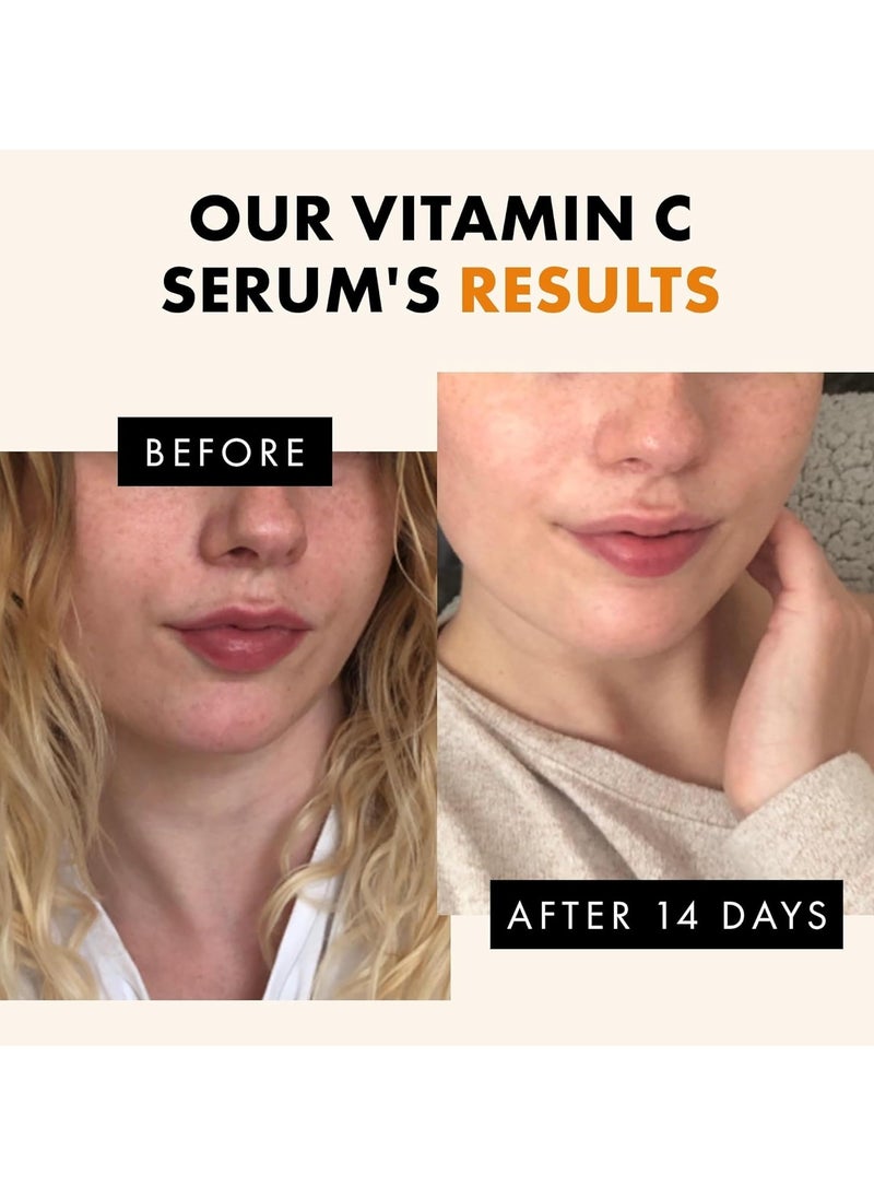 Eclat Skincare - Organic 20% Vitamin C Serum for Face WITH HYALURONIC ACID +RETINOL +FERULIC ACID +JOJOBA OIL +VIT E - Anti Aging Brightening Face Serum for Pure Skin Glow - Reduce Wrinkles & Dark Spots (Vegan) - Image 1