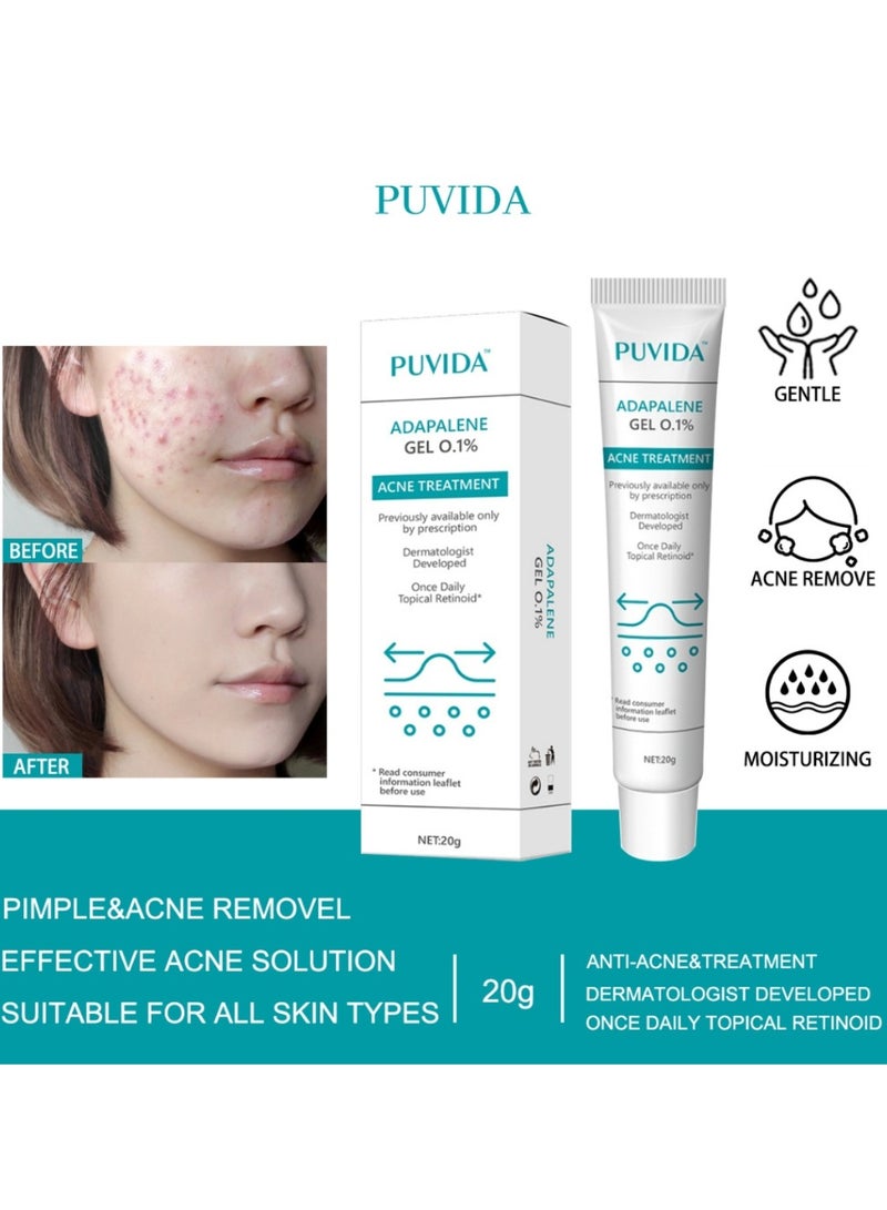PUVIDA Acne Treatment Cream Acne Treatment Ointment Gel Adapalene Gel for Acne Treatment Gentle Moisturizing Acne Removing Gel Pimple and Acne Removal Anti Acne and Treatment Gel 20G - Image 3
