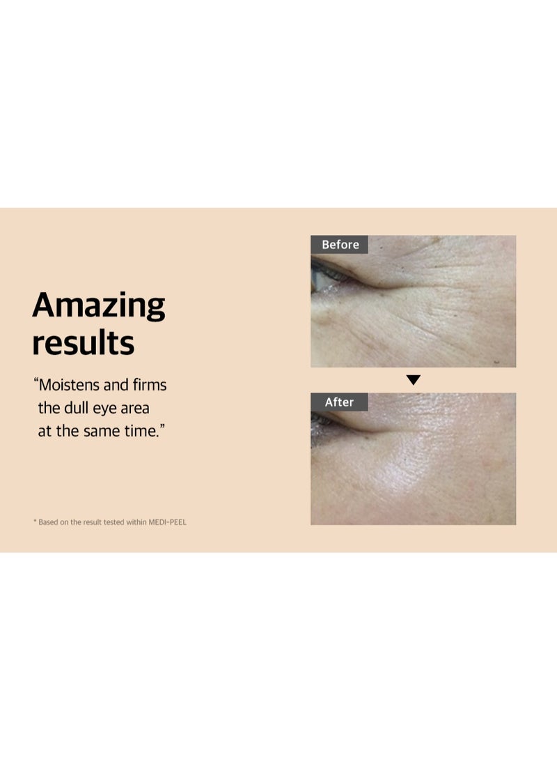 MEDI-PEEL [ميدي-بيل] سيروم ميزو فيلا تحت العين 1.01 أونصة سائلة / 30 مل | سيروم مضاد للتجاعيد للعيون، مضاد للشيخوخة، مرطب | العناية بالبشرة الكورية، لجميع أنواع البشرة - Image 5
