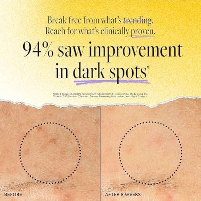 derma-e DERMA E Vitamin C Concentrated Serum, 2 Oz, with Hyaluronic Acid, Vitamin E & Aloe, All Natural, Antioxidant-Rich Concentrated Formula, Hydrating & Brightening Vitamin C Face Serum - Image 3