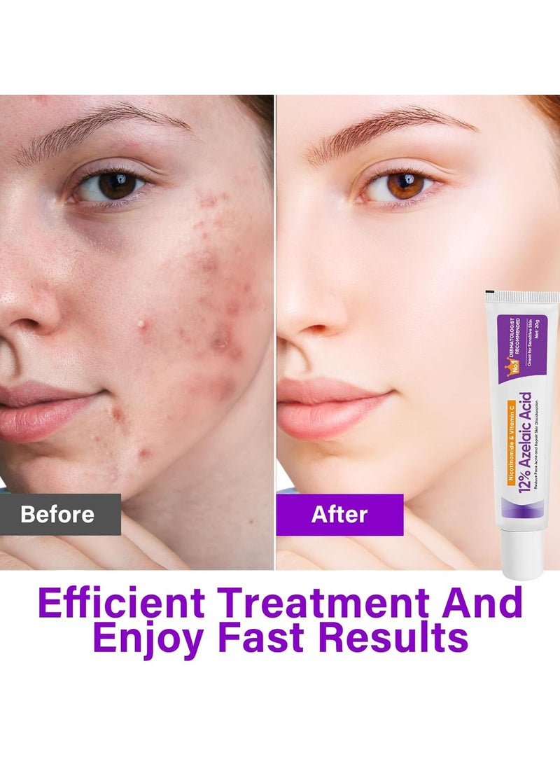 يوج 12%Azelaic Acid Serum, Lighten Acne Marks,Relieves Redness, Dark Spots, Rosacea, Balances Excess Sebum, Brightening Face Skin Care Treatment for All Skin Types 20g - Image 4