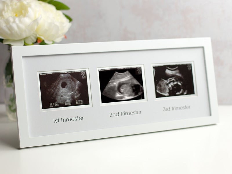 BEABA Pearhead Trimester Sonogram Picture Frame, Pregnancy Photo Milestone Wall Decor, Ultrasound Keepsake, Gender-Neutral Baby Nursery Décor, White - Image 2