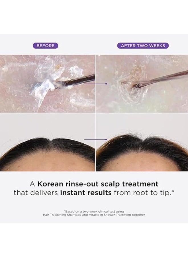 Dr.Groot Dr. Groot Miracle in Shower Treatment for Hair Loss, Korean Hair Care, 5 Seconds to Smooth Hair, Rosemary Oil for Healthier-Looking Hair, Hair Rinse, Moisturizing Treatment,Scalp Revitalizing Solution - Image 2