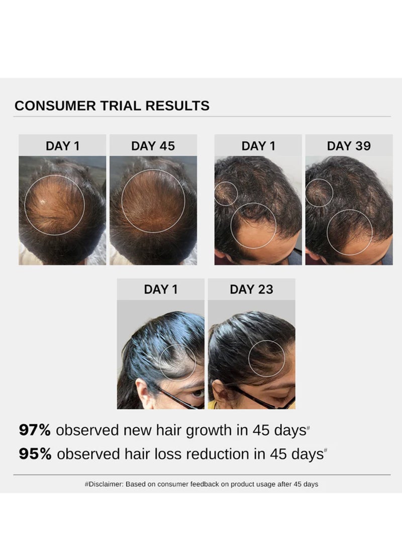 BARE ANATOMY - Advanced Hair Growth Serum with Redensyl, Rosemary, Rice Water (30 ml) - Image 1